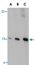 PAB13229 - PEN2