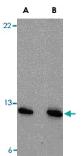PAB13230 - PEN2
