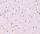 PAB13231 - Nicastrin