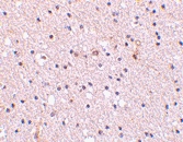 PAB13232 - Nicastrin