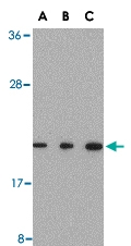 PAB13235 - TMED10 / TMP21