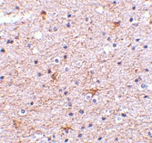 PAB13235 - TMED10 / TMP21