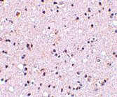 PAB13236 - TMED10 / TMP21