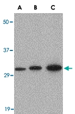 PAB13237 - APH1A