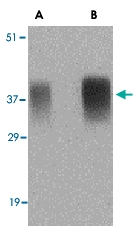 PAB13238 - APH1A