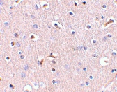 PAB13238 - APH1A