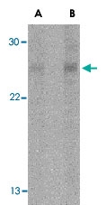PAB13239 - RPAIN / RIP