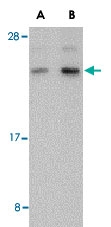 PAB13241 - BANF1