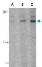 PAB13242 - BANF1