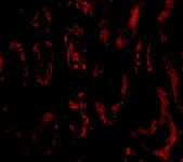 PAB13242 - BANF1