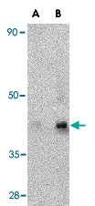 PAB13244 - CD294 / GPR44