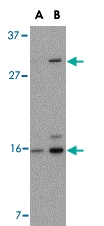 PAB13245 - DRAM1