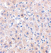 PAB13245 - DRAM1