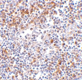 PAB13246 - Helicard