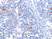 PAB13247 - Helicard