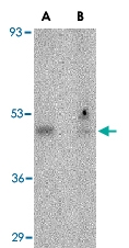 PAB13248 - ORAI1
