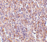 PAB13248 - ORAI1