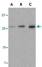 PAB13249 - TIGAR
