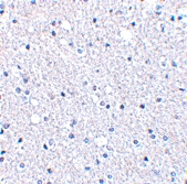 PAB13249 - TIGAR