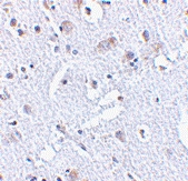 PAB13250 - TIGAR