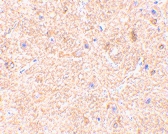PAB13252 - MAVS