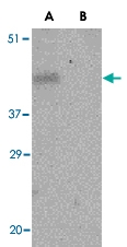 PAB13253 - CD279 / PD1