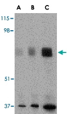 PAB13256 - MIP1