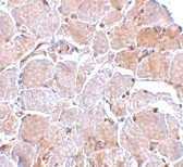 PAB13256 - MIP1