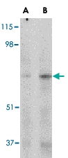 PAB13257 - MIP1