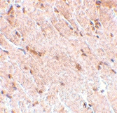 PAB13257 - MIP1