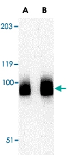 PAB13258 - BRSK1