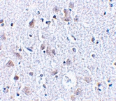PAB13258 - BRSK1
