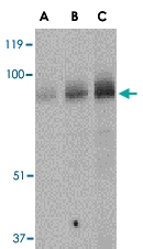 PAB13259 - BRSK1