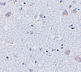 PAB13259 - BRSK1