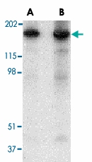 PAB13260 - Reticulon-4 / RTN4