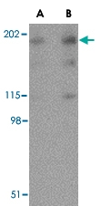 PAB13261 - Reticulon-4 / RTN4