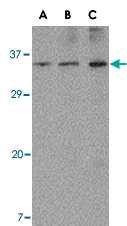 PAB13264 - ORAI3