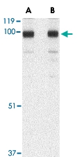 PAB13265 - STIM2