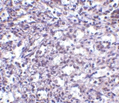 PAB13265 - STIM2
