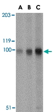 PAB13266 - STIM2