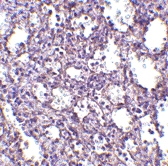 PAB13266 - STIM2