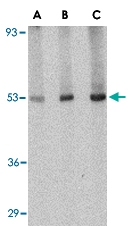 PAB13267 - CRLF2