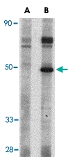 PAB13268 - CRLF2