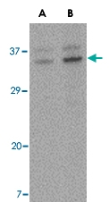 PAB13269 - ORAI3