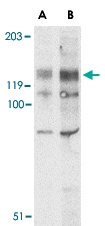 PAB13270 - BUB1A