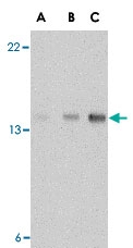 PAB13271 - Stathmin / STMN1