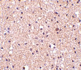 PAB13271 - Stathmin / STMN1