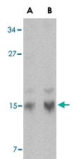 PAB13272 - Stathmin / STMN1