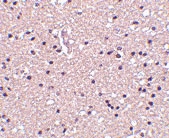 PAB13272 - Stathmin / STMN1