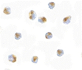PAB13273 - BUB1A